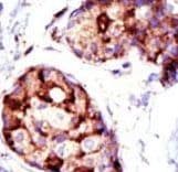 TSG101 Antibody (aa1-30)