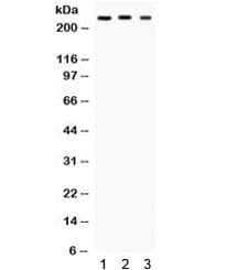 SCN1A / Nav1.1 Antibody