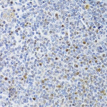 MKI67 / Ki67 Antibody