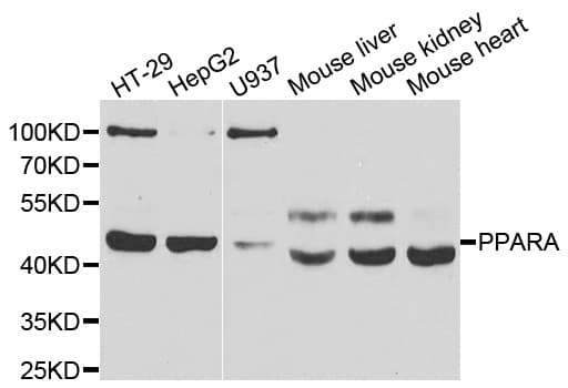 IHC-plus™ Polyclonal Rabbit anti-Human PPARA / PPAR Alpha Antibody (IHC, WB)
