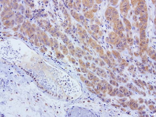 L1CAM Antibody (clone UMAB47)