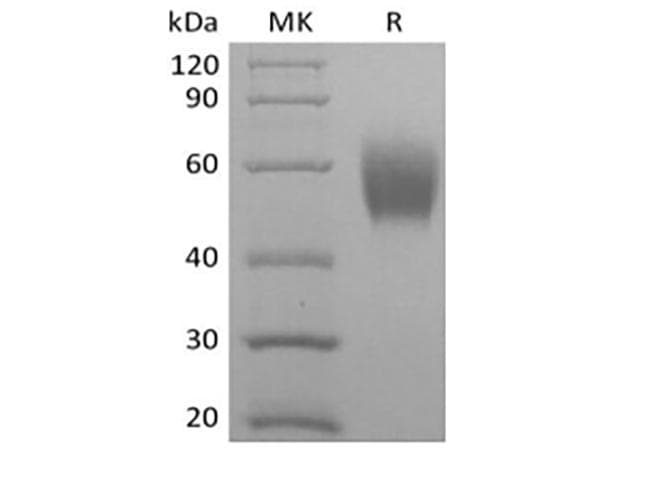 Cynomolgus SIRPA / CD172a Protein (Recombinant 6His, C-terminus)