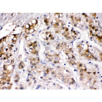 Polyclonal Rabbit anti-Human CP / Ceruloplasmin Antibody (aa20-259, IHC, WB)