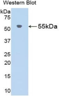 AGT / Angiotensinogen Antibody (aa25-477, APC)