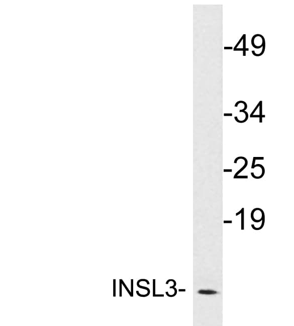 IHC-plus™ INSL3 Antibody (aa19-68)
