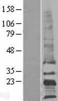CD81 Protein (Over-Expression Lysate Myc-DDK (Flag))