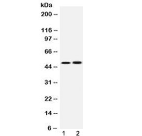 IKBKG / NEMO / IKK Gamma Antibody