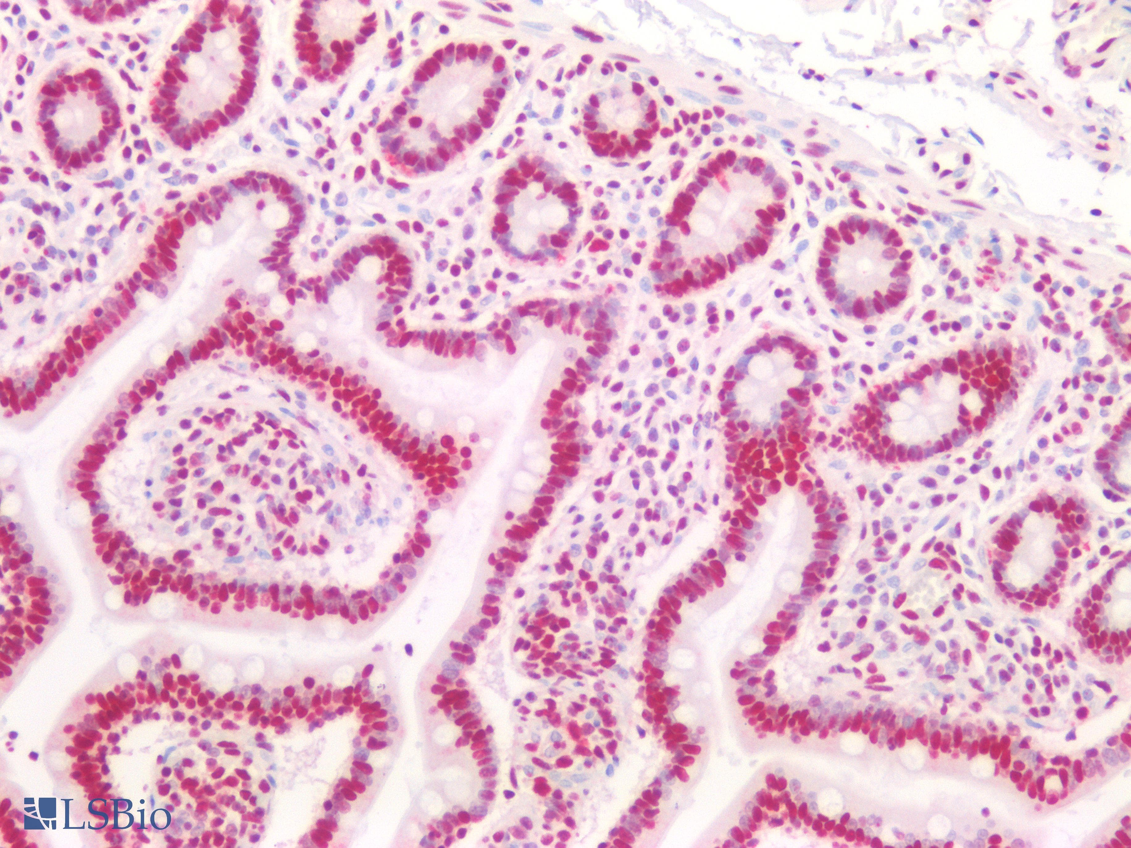 PathPlus™ Monoclonal Mouse anti-Human CBX3 / HP1 Gamma Antibody (IHC, WB)