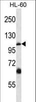 Polyclonal Rabbit anti-Human TRPC5 Antibody (aa254-283, IHC, WB)