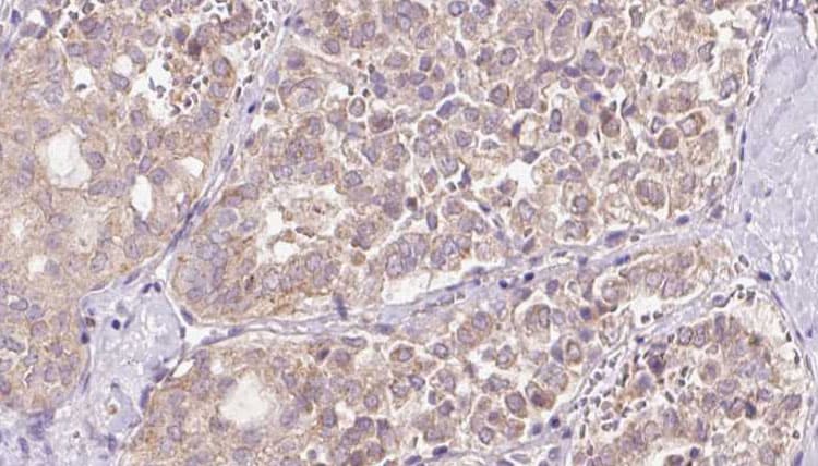 Polyclonal Rabbit anti-Human REEP2 Antibody (IHC, WB)