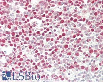IHC-plus™ Polyclonal Rabbit anti-Human HAT1 Antibody (aa389-419, IHC, WB)