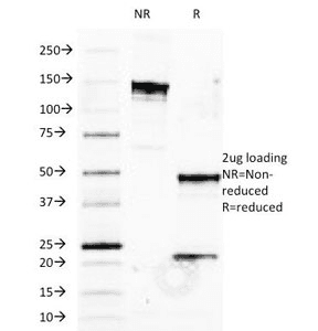 HLA-B Antibody (clone JOAN-1)