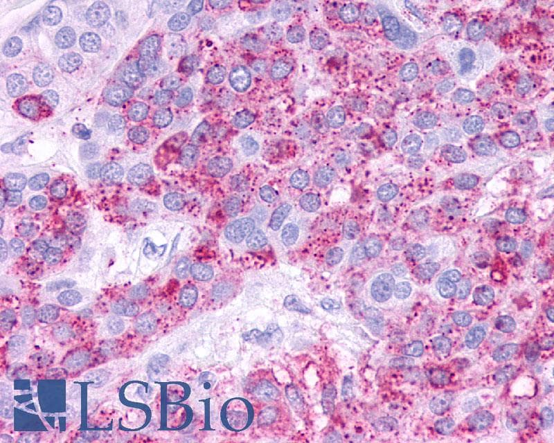 PathPlus™ Polyclonal Rabbit anti-Human GPBAR1 / TGR5 Antibody (C-Terminus, IHC)
