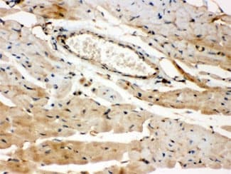 ROCK2 Antibody