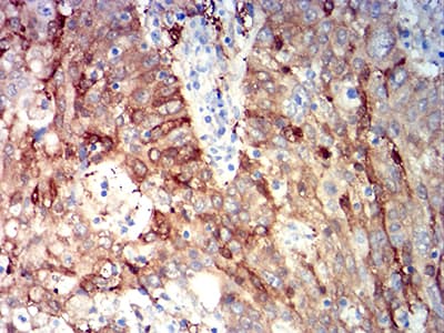 ALDH1A1 / ALDH1 Antibody (clone 2B2G1)