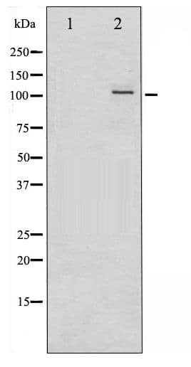 NFKB2 Antibody (phospho-Ser865)