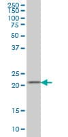 DHFR Antibody (clone 2B10)