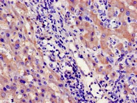 CYP39A1 Antibody