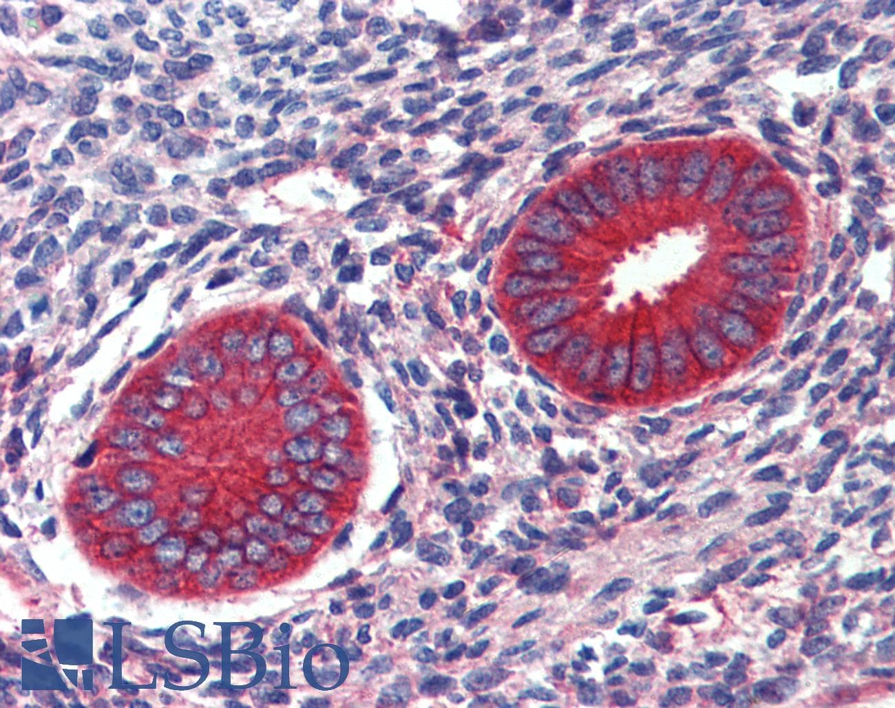 IHC-plus™ EPB41L2 Antibody (aa347-357)