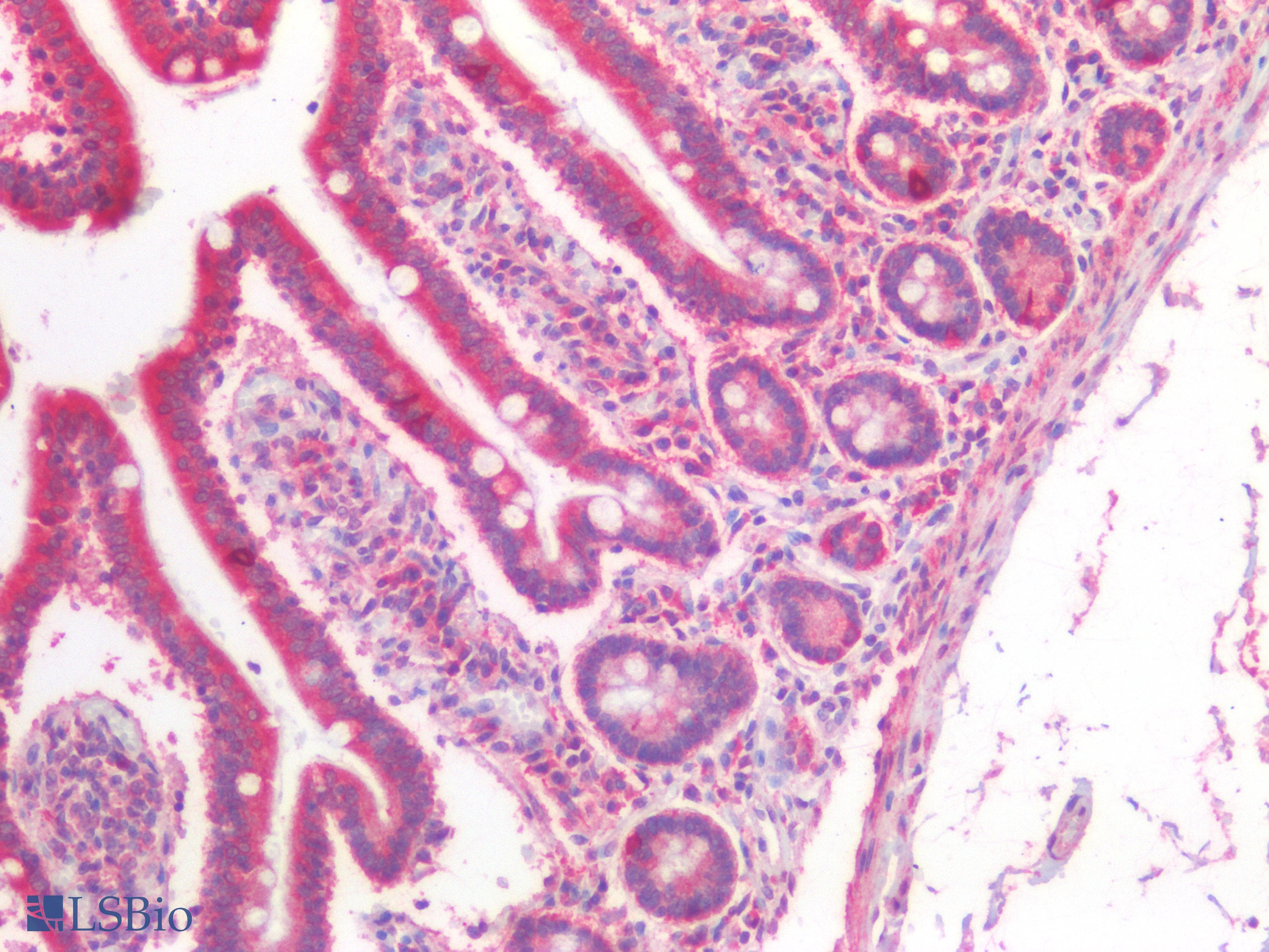 PathPlus™ Polyclonal Rabbit anti-Human IFIH1 / MDA5 Antibody (IHC)