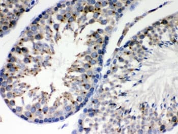 EBAG9 / RCAS1 Antibody