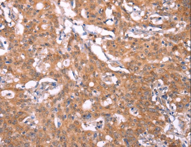 FBXO31 Antibody