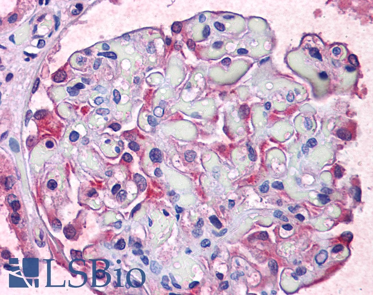 IHC-plus™ Polyclonal Rabbit anti-Human TCTN2 Antibody (IHC, WB)