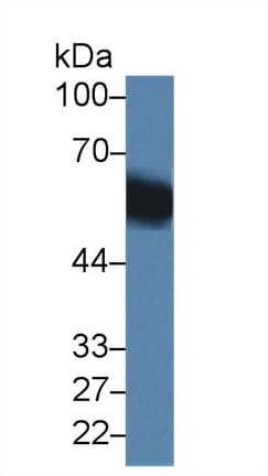 GC / Vitamin D-Binding Protein Antibody (aa17-476)