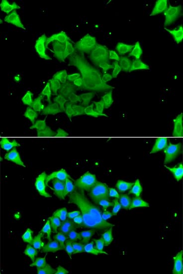 RAD51L3 / RAD51D Antibody