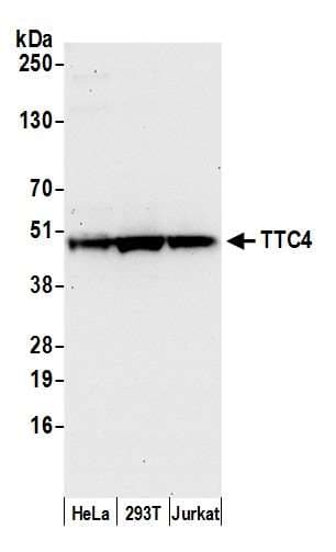 TTC4 Antibody (aa1-50)