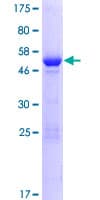 Human NSMCE1 Protein (Recombinant GST)