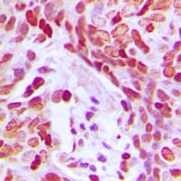 MEF2D Antibody (phospho-Ser444)