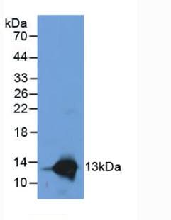 S100A8 / MRP8 Antibody (aa1-93)