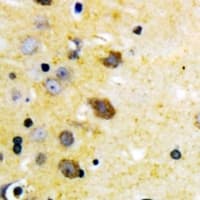Polyclonal Rabbit anti-Human MAP2K4 / MKK4 Antibody (IHC, WB)