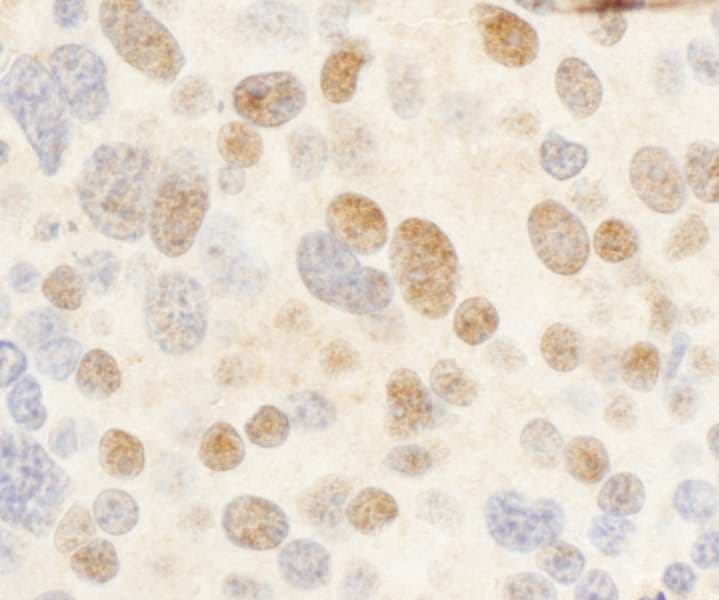 cmyb Antibody (aa1-50)
