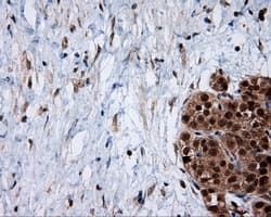SRR / Serine Racemase Antibody (clone OTI7E8, Carrier-free)