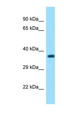 Polyclonal Rabbit anti-Mouse FBXO2 Antibody (C-Terminus, WB)