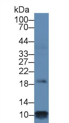 PLN / Phospholamban Antibody (aa1-52)