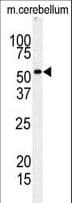 Polyclonal Rabbit anti-Human RIPK3 / RIP3 Antibody (aa61-91, IHC, WB)