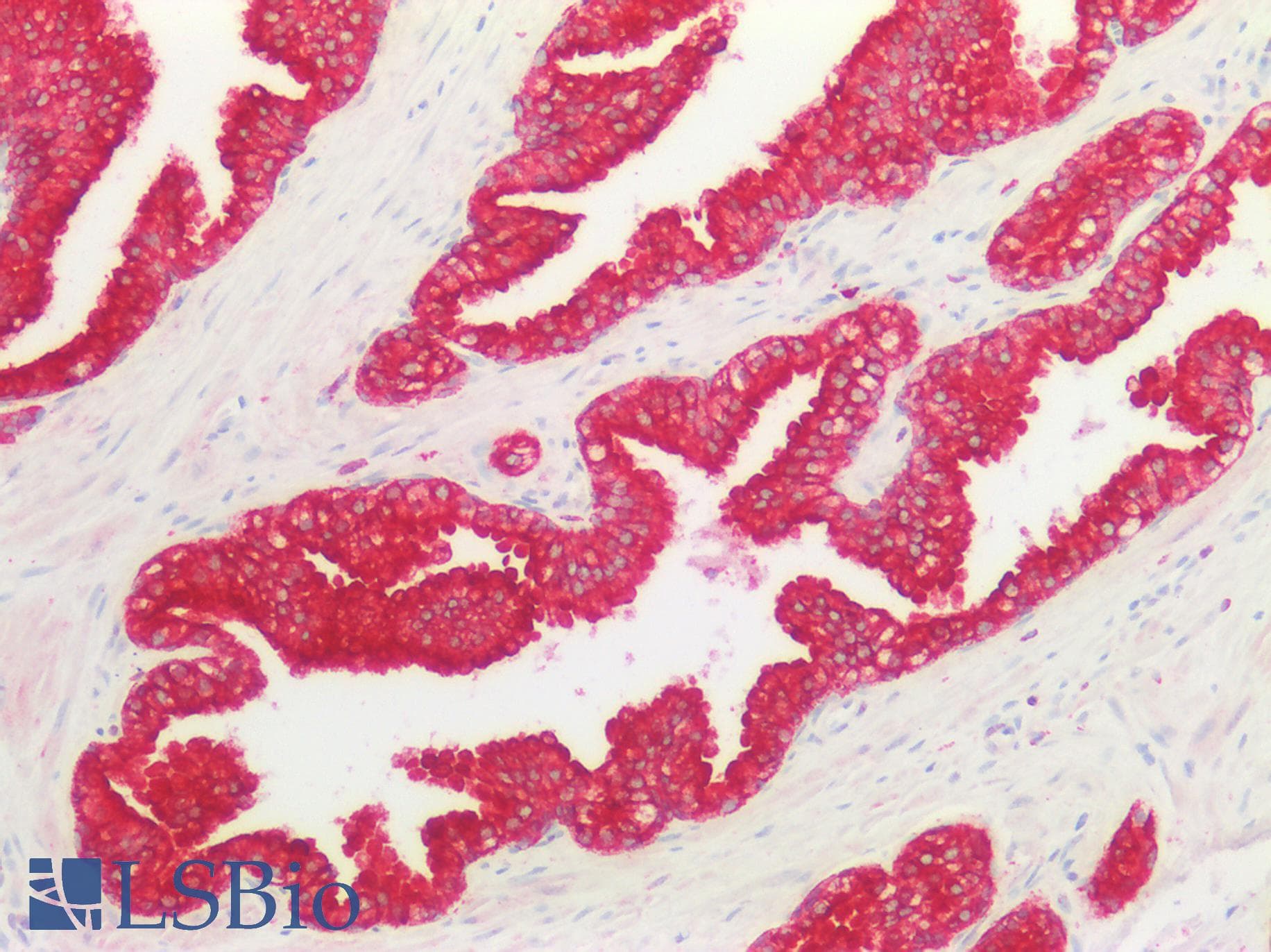 PathPlus™ KRT8 / CK8 / Cytokeratin 8 Antibody (aa25-74)