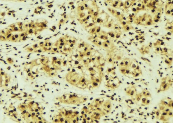 PRKACA Antibody