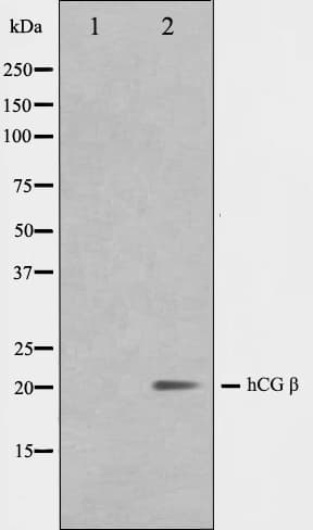 CGB / hCG Beta Antibody (aa122-148)