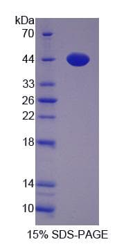 Rat UROD Protein (Recombinant His-S)