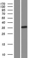 CREM / ICER Protein (Over-Expression Lysate Myc-DDK (Flag))