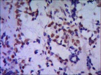 Monoclonal Mouse anti-Human TBL1XR1 / TBLR1 Antibody (IHC, WB)