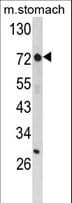 Polyclonal Rabbit anti-Human ZNF823 Antibody (aa119-148, IHC, WB)