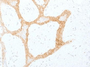 Monoclonal Mouse anti-Human Cytokeratin 5+8 Antibody (clone C-50, IHC, IF, WB)