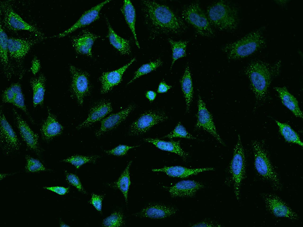 Polyclonal Rabbit anti-Human MED28 / Magicin Antibody (IF)