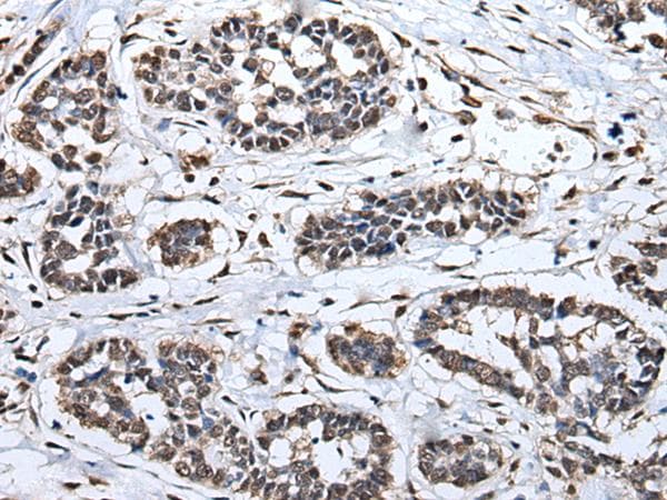 HNRNPH2 / hnRNP H2 Antibody