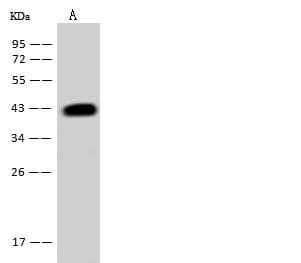 Polyclonal Rabbit anti-Human ACADSB Antibody (IHC, WB)